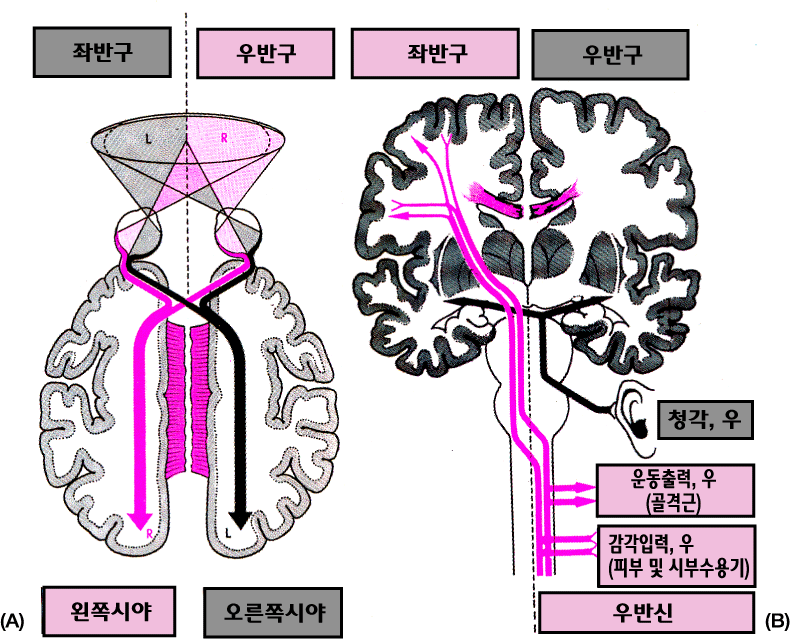 <그림 
12> 양단뇌환자에서 볼 수 있는 체성 &nbsp;감각, 운동, 시각, 청각의 섬유 연락<br>